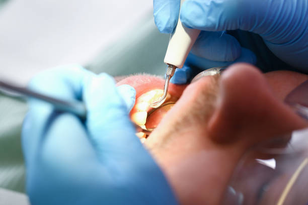 Best After-Hours Dental Trauma Care in Goldstream, AK