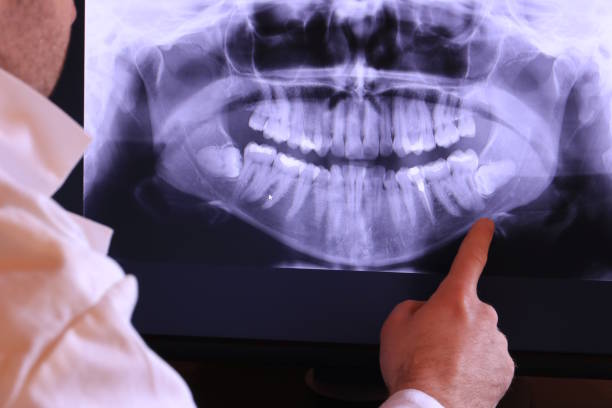 Best Emergency Treatment for Dental Infections or Abscesses in Goldstream, AK